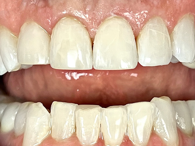 01 cosmetic after