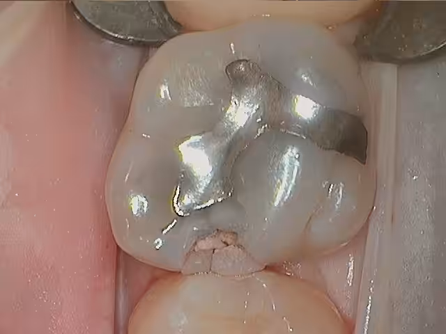 Chris Alloy Replacement Before