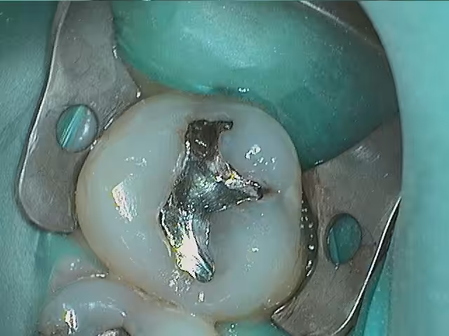 David Failing Amalgams Before Photo1