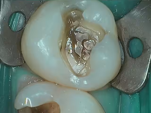 David Failing Amalgams During Photo1