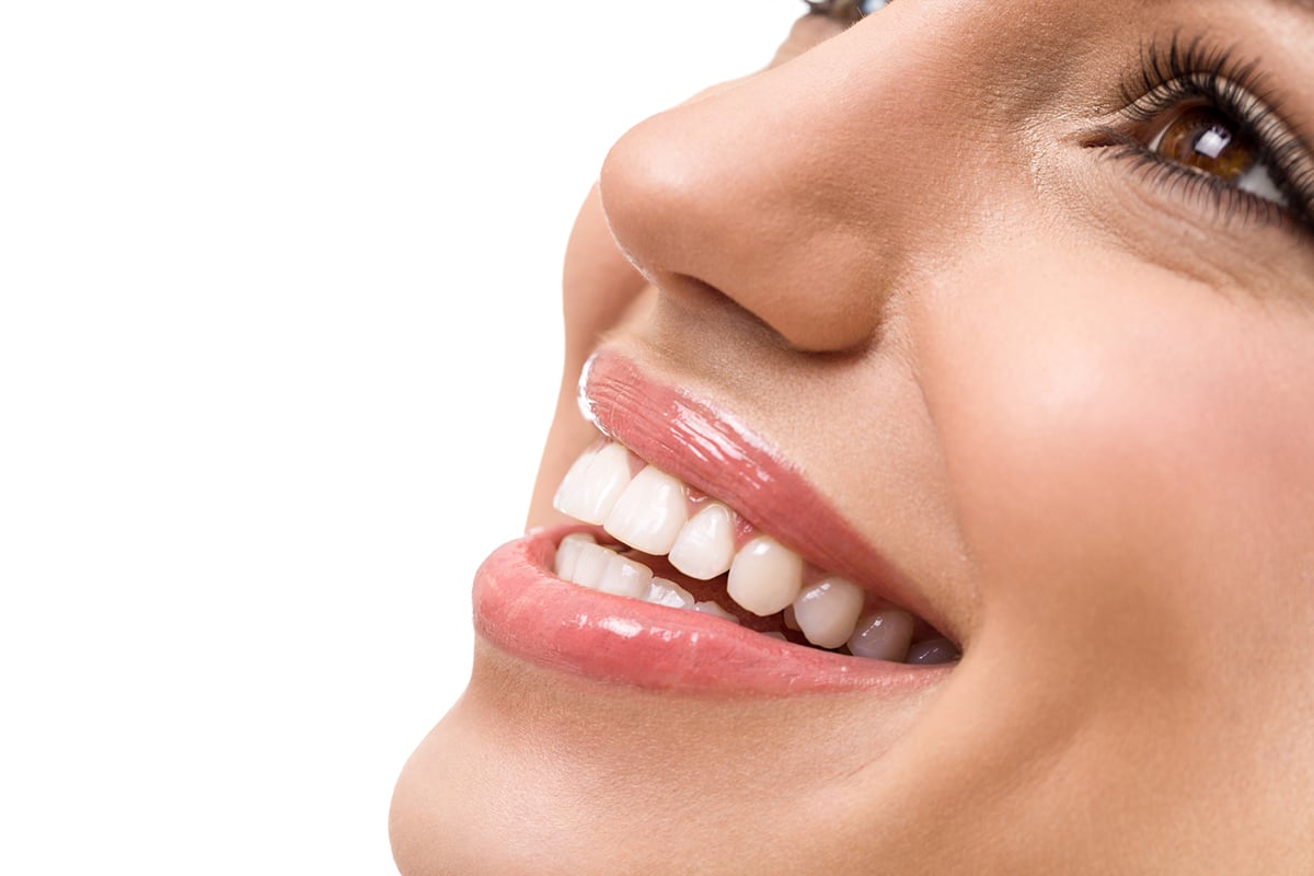 How Much Do Dental Veneers Cost In Santa Barbara Ca Blog
