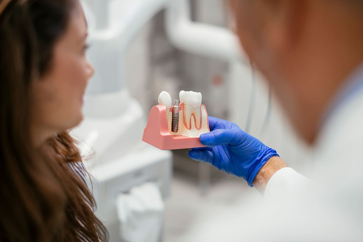 How To Care For Your Dental Implants After Surgery Blog